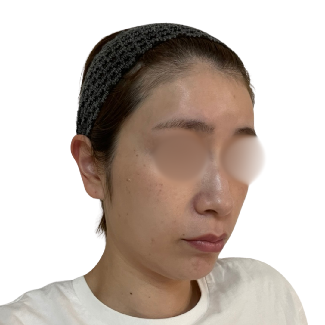 ピコスポット